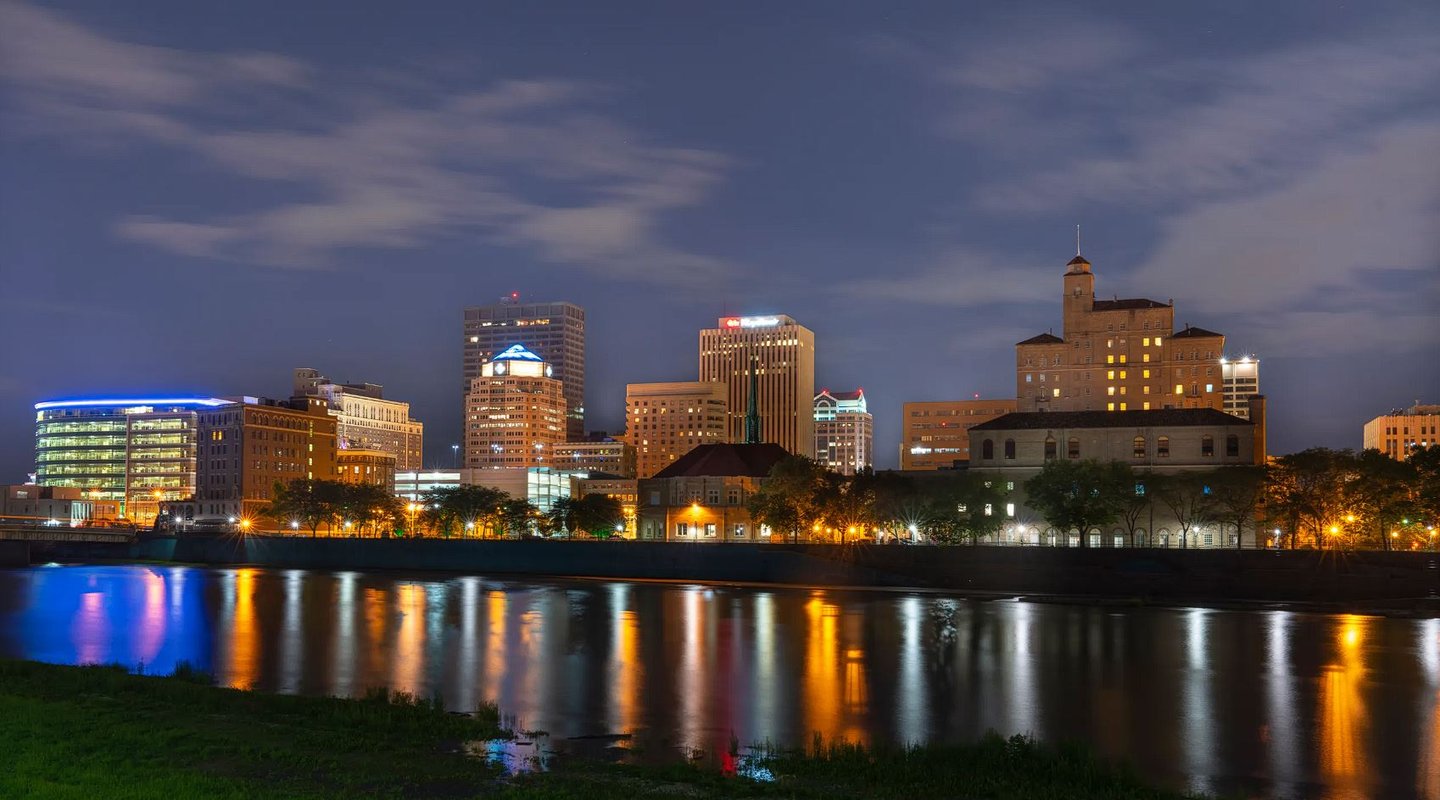 EKG Test Near Me Understanding ECG Test Procedure and Results