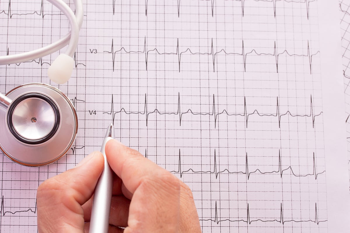 Electrocardiogram (ECG/EKG) certification