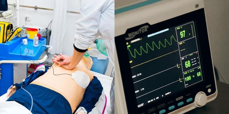 ACLS vs EKG